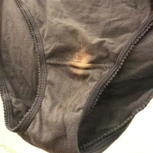 What a “Bleach” Patch on Your Underwear Means