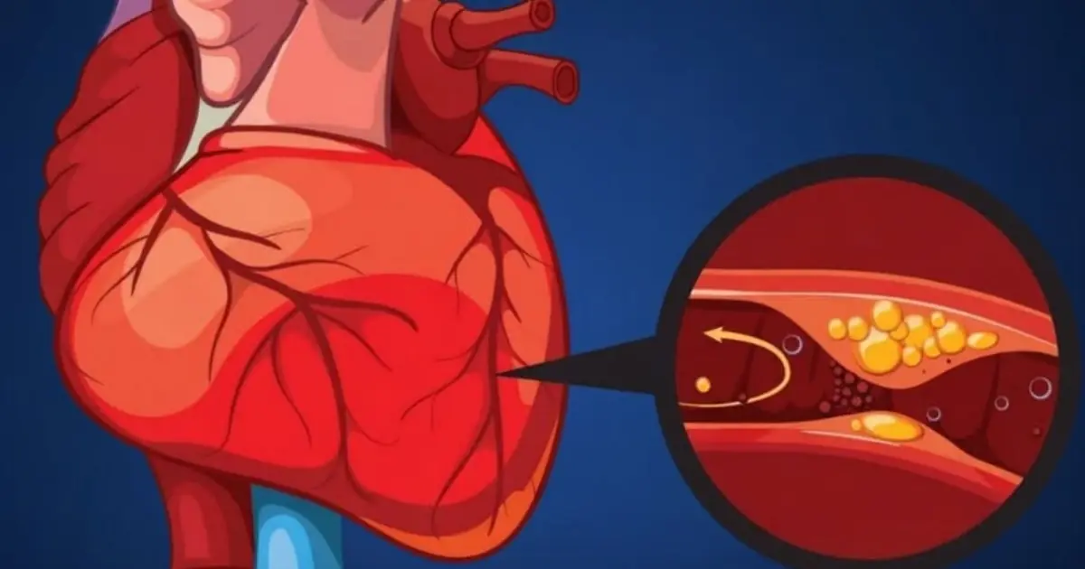 Heart-Healthy Foods That Could Help Keep Your Arteries Clear and Healthy