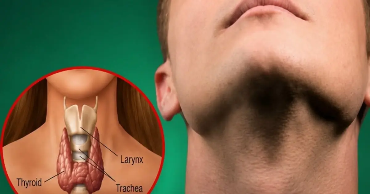 Your Thyroid Is Begging You to Stop Eating These 6 Foods Immediately