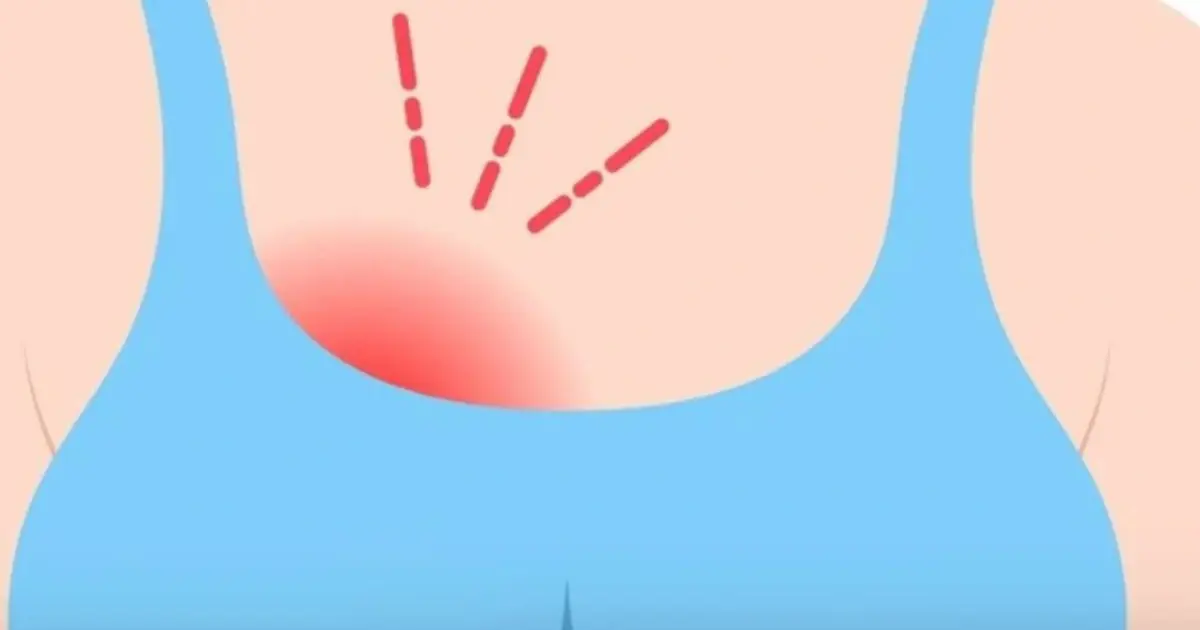 The Body Whispers First: Warning Signs of Breast Can.cer That May Appear a Year Before Diagnosis