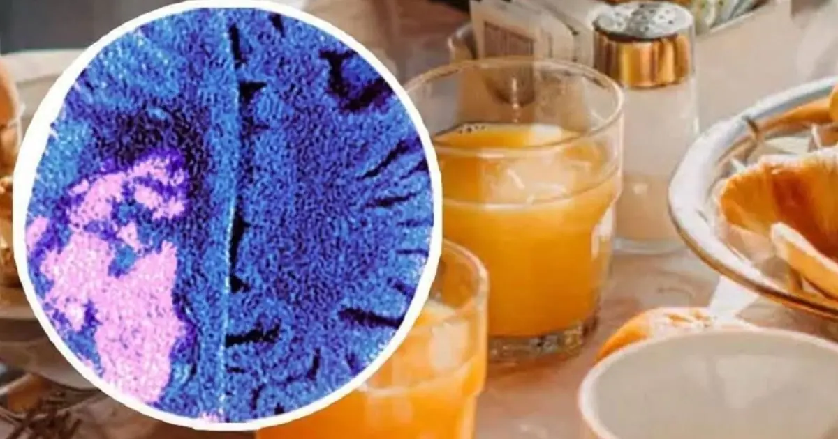 Warning Issued Over Popular Breakfast Foods Linked to Higher Stroke Risk