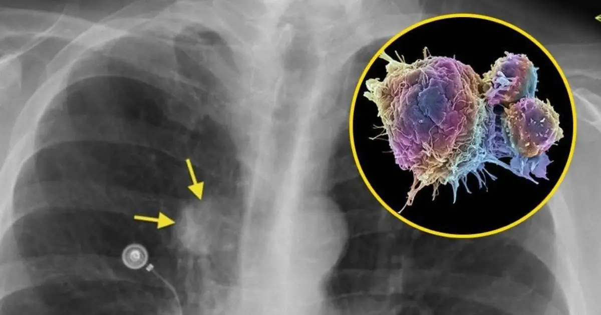 20 Early Signs Your Body May Be Sending Important Health Signals