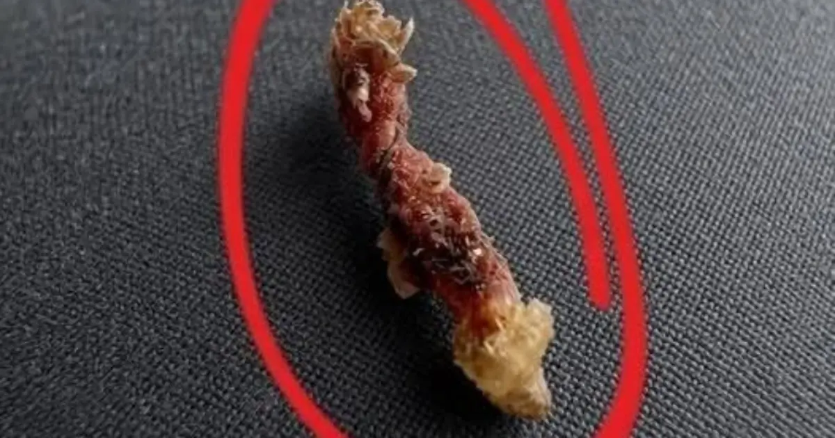 I Woke Up Feeling Like Something Was Biting Me - Then I Discovered the Shocking Truth