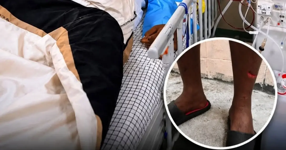 Kidney Failure Doesn't Happen Overnight — Watch for These Clues