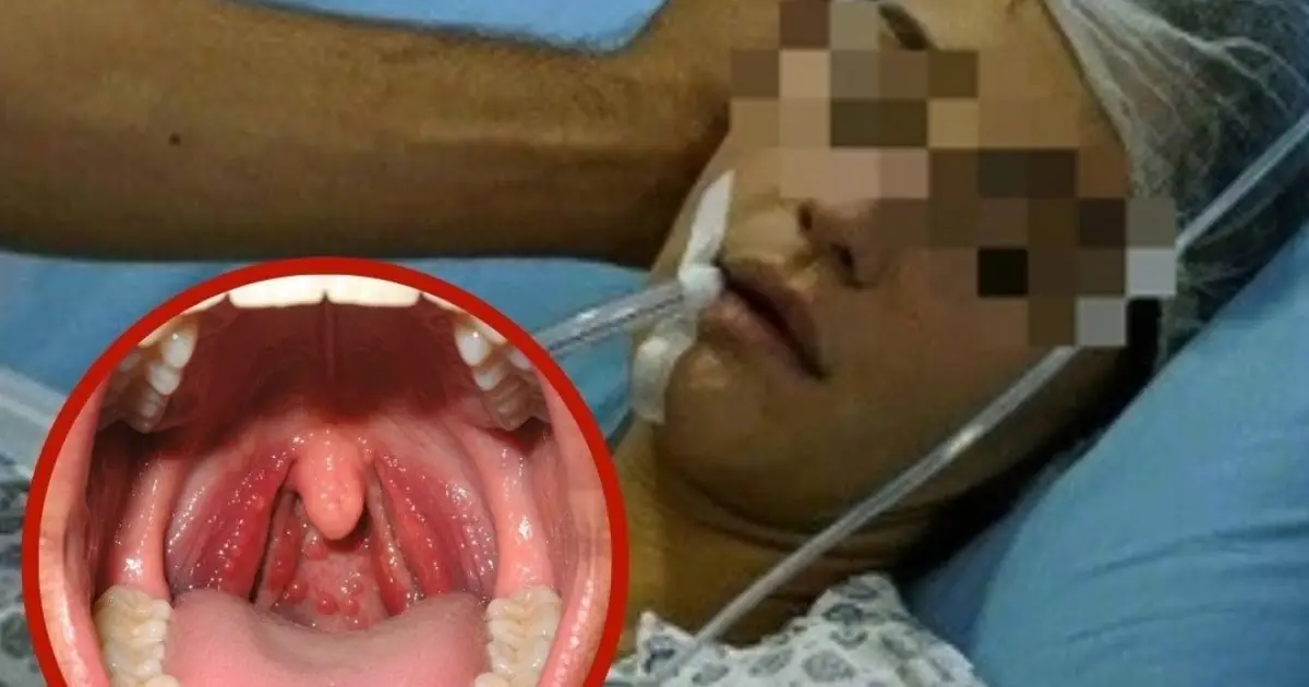 She Thought It Was Just A Sore Throat. Five Days Later, She Was D.ead