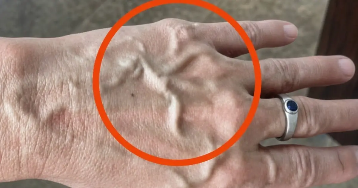 If You Have Visible Veins, It Means You Are…? What Your Body May Be Trying to Tell You