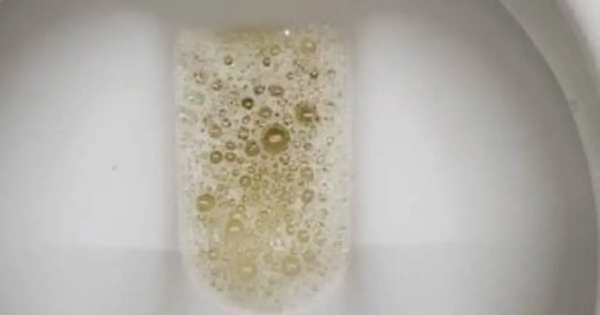 Noticing Foam in Your Urine? Here’s What Your Body May Be Telling You