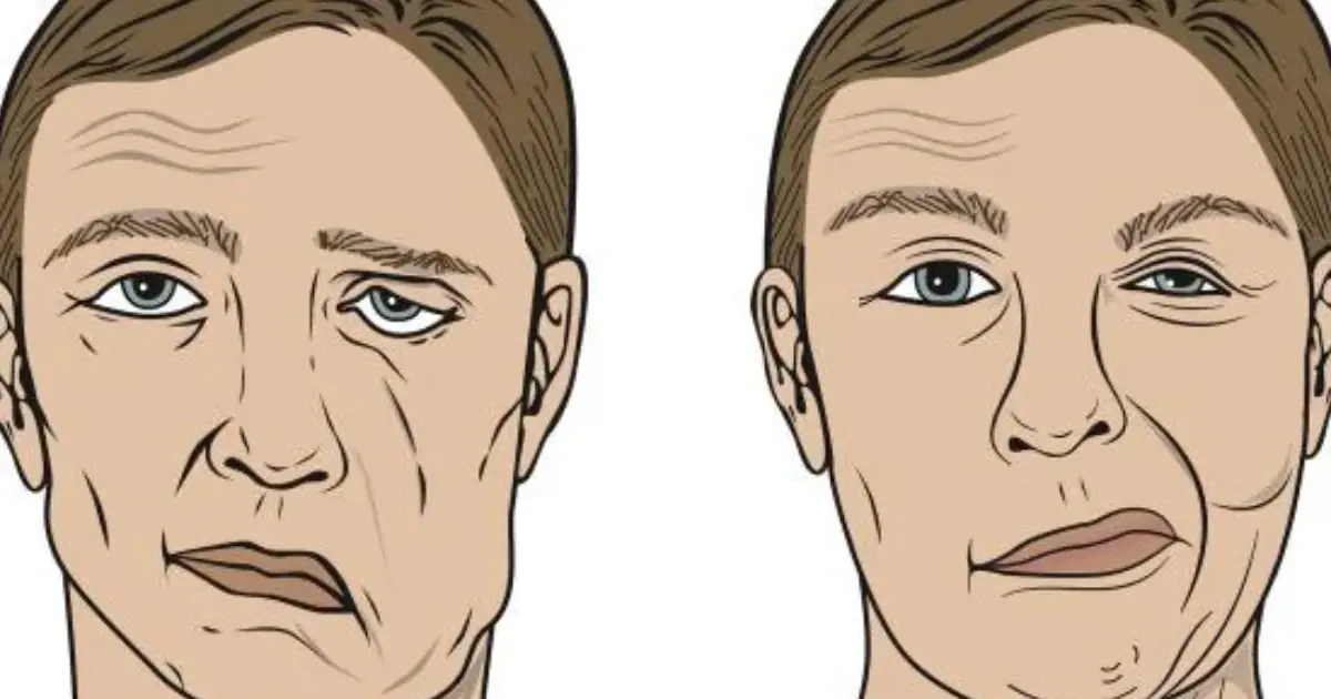 This Symptom May Be Your Body’s Early Stroke Warning—It Can Appear Up to 90 Days Before