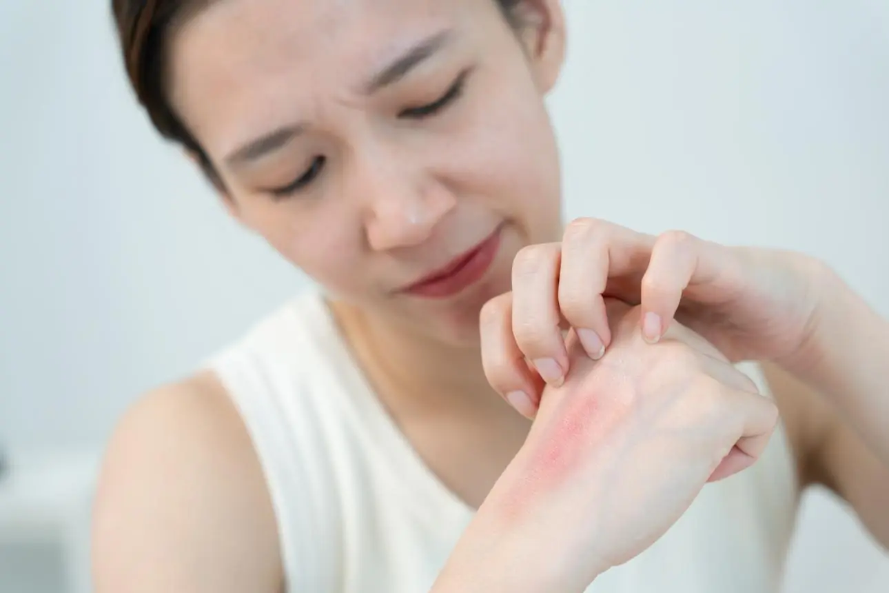 If You Notice These Tiny Blisters on Your Skin, Don’t Ignore Them