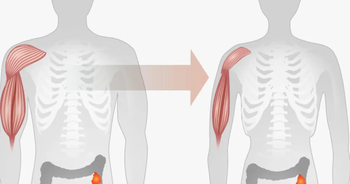 The Silent Signal: What Your Legs May Reveal About Pancreatic Health