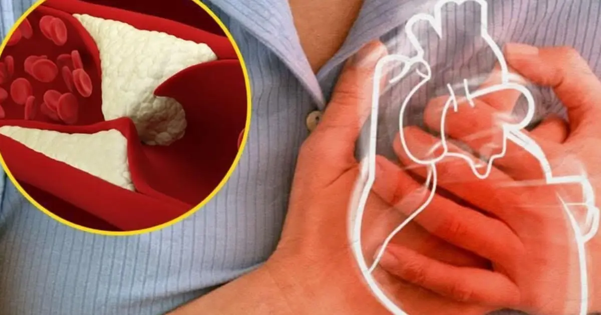 10 Warning Signs That May Suggest Your Arteries Are Becoming Narrowed