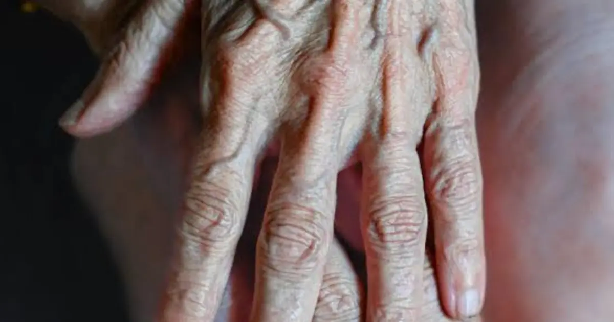 If You Notice Prominent Veins on Your Body, Here’s What It Could Mean…