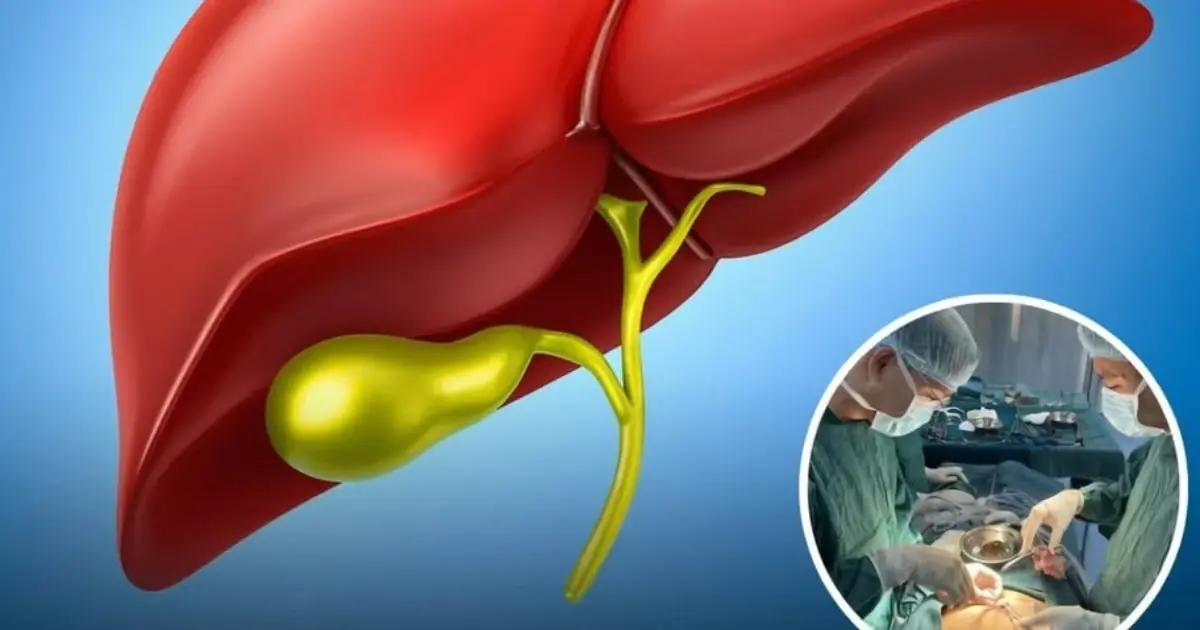 Gallbladder Removed? Here’s What Happens Next in Your Body
