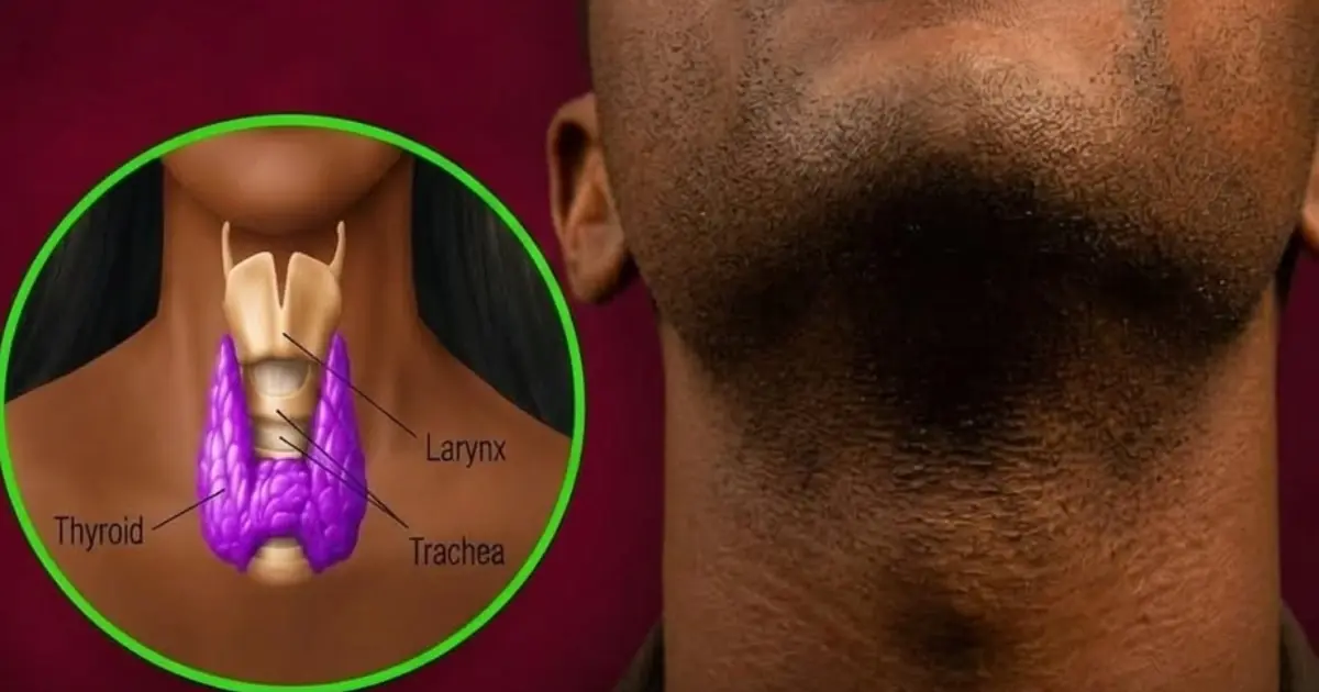 Your Thyroid Works Hard Every Day — These 6 Foods May Make It Harder