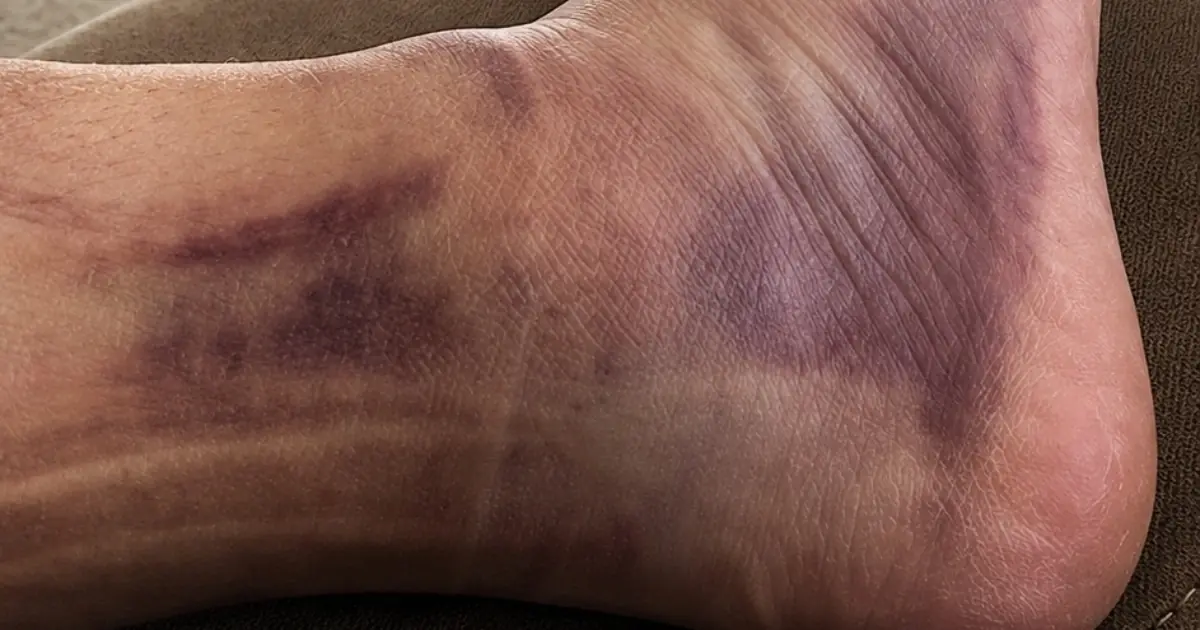 These are the consequences of wearing… See more