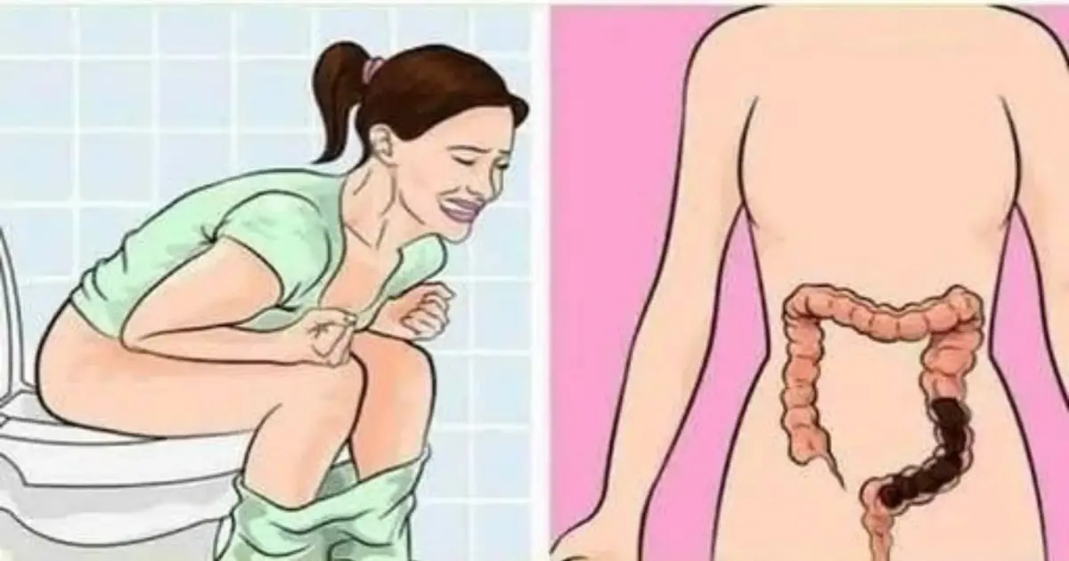 20 Subtle Cancer Symptoms Commonly Missed