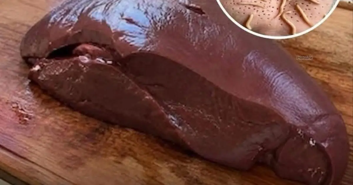Doctors reveal that eating beef liv.er can cause...See more