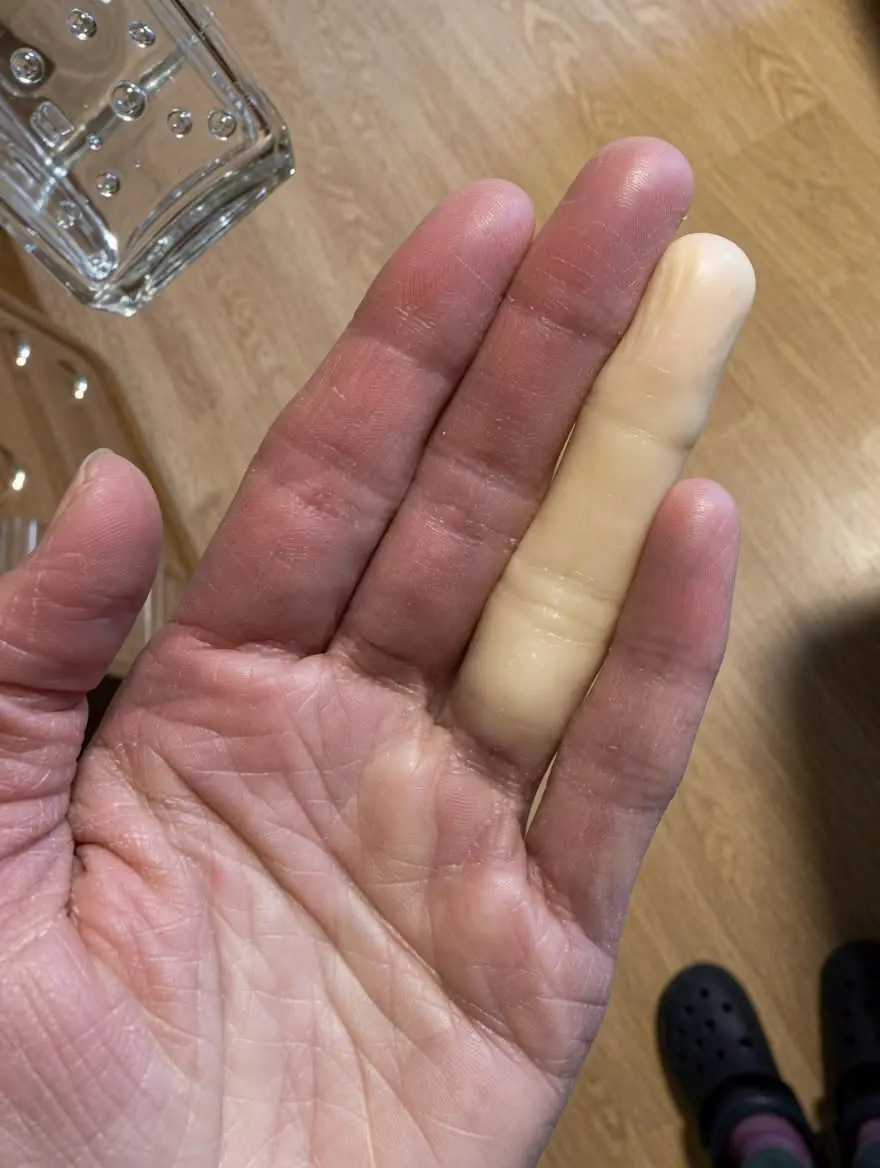 The Midnight Chill: Why You Might Wake Up with a Pale, Numb Finger (And How to Gently Restore Warmth and Circulation)