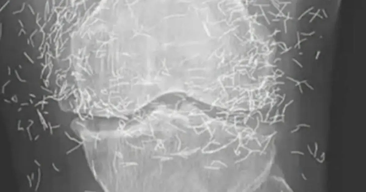 Doctors Examined Her Knee and Discovered Something Surprisingly Valuable