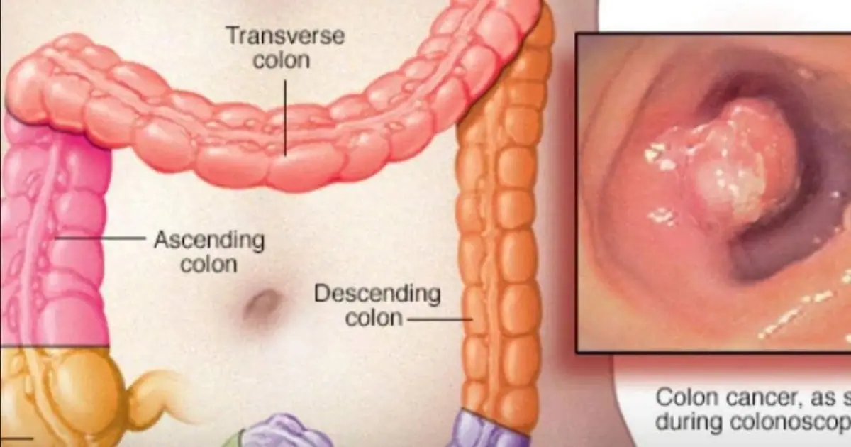 40+ Weird Signs That Lead To a Cancer Diagnosis