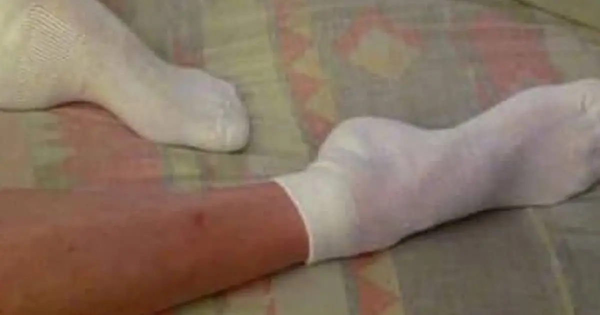 Sleeping With Socks On: Surprising Benefits and What Experts Say