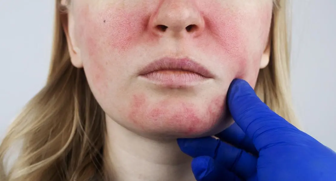 Why Sleeping With an Unwashed Face Could Be Harming Your Skin