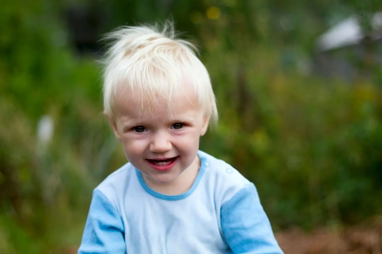The Boy With Snow-White Hair Who Captivated the World – Where Is He Now?