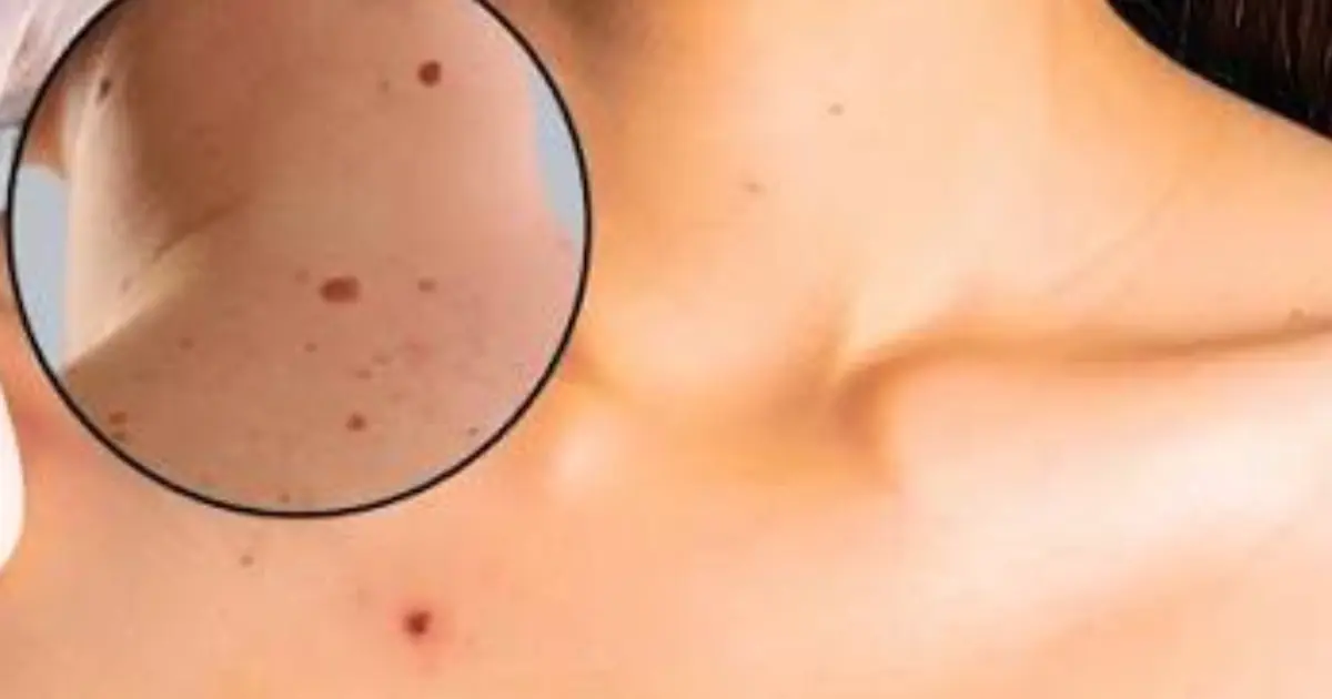 See These Small Red Dots Appearing on Your Skin? Don’t Ignore Them Until You Know What They Could Mean…