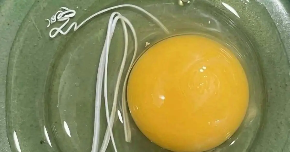 I Was Worried About the White String in My Egg—But the Truth Was Surprisingly Simple