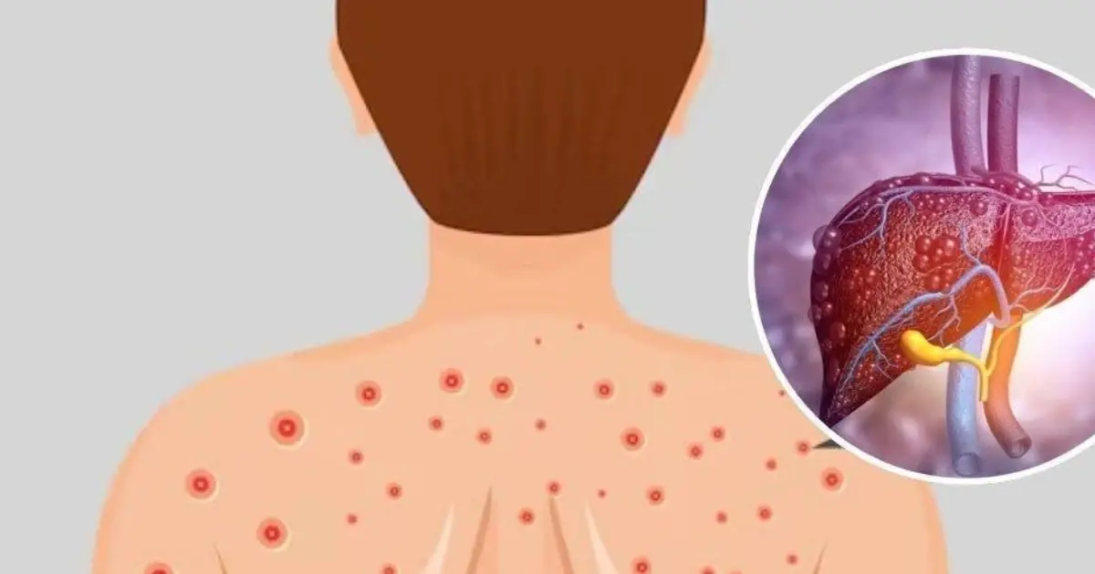 Health experts emphasize that recognizing the early warning signs can lead to earlier treatment and better blood sugar control