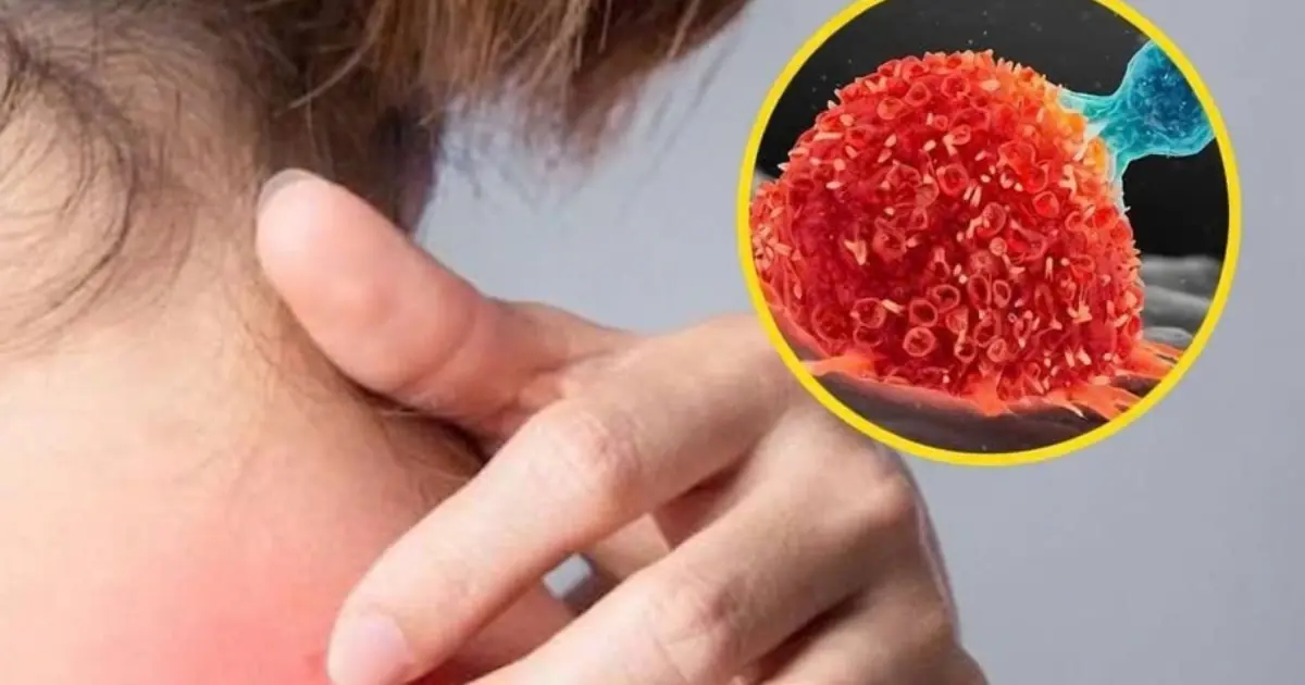 These 9 Unusual Itching Symptoms Could Be Your Body’s Way of Signaling Underlying Illness.