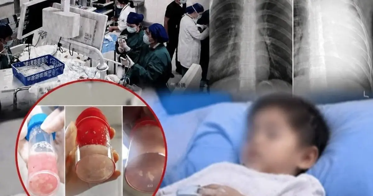 This frightening case shows how quickly a child's condition can deteriorate.