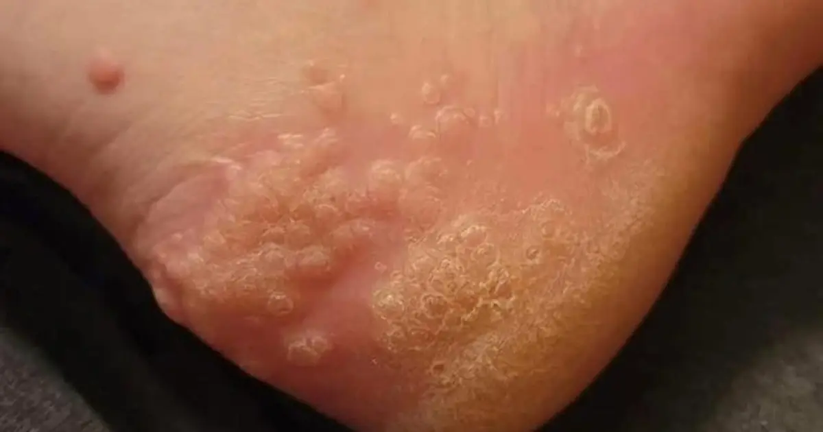 These Are the Consequences of Wearing...