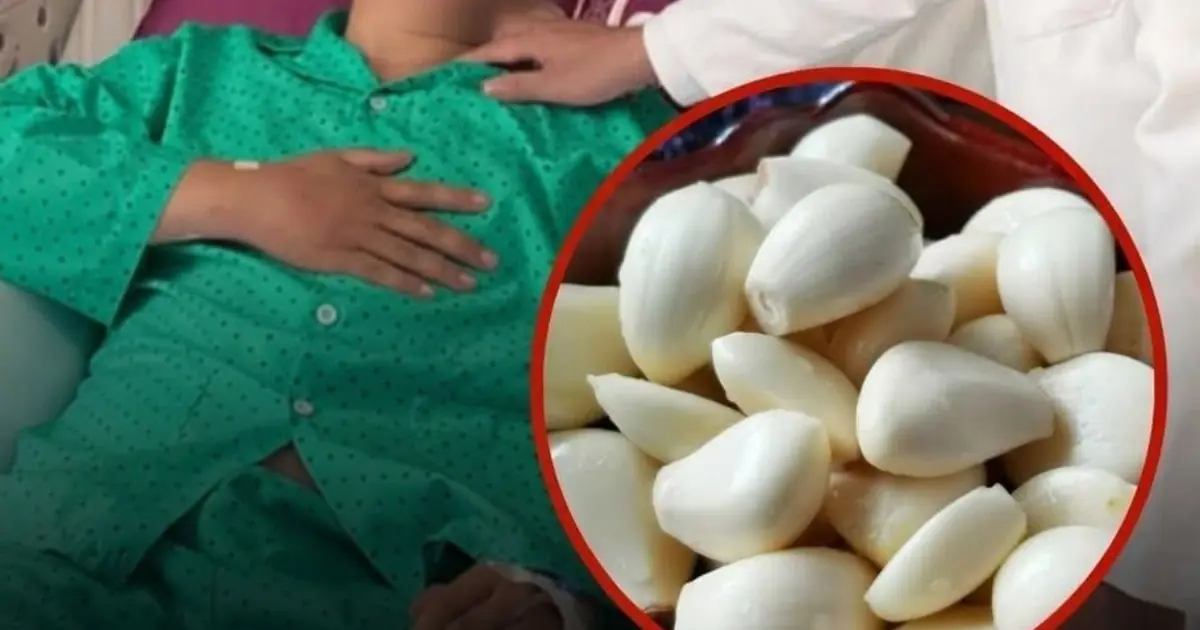 He Ate Garlic Every Day For 5 Months Hoping To Heal His Kid.neys The Results Shocked Doctors