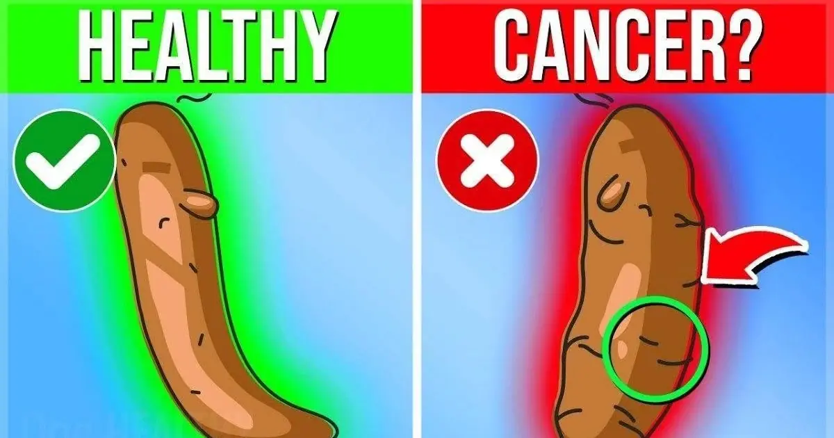 What different stool colors mean for your body?