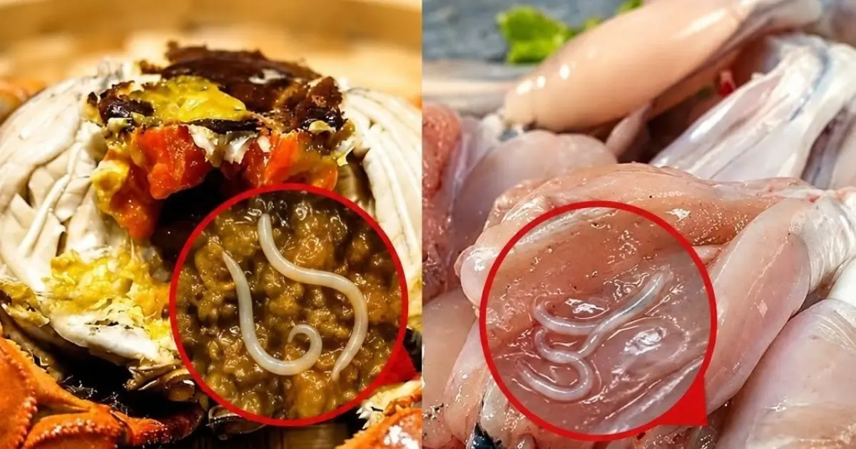 Doctors Warn: These 4 Popular Foods May Hide Dangerous Parasites