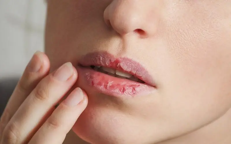 8 Strange Signs Your Body Is Begging for Vitamin B12