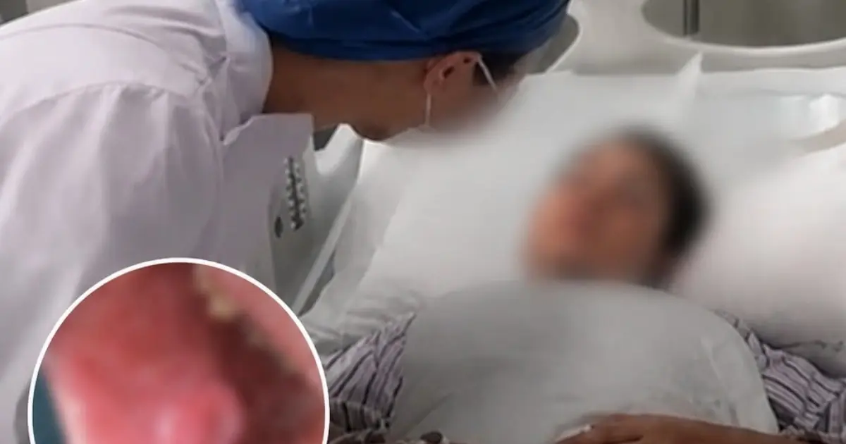 She Ate Steamed Food Every Day—Doctors Say One Habit Turned It Dang.erous