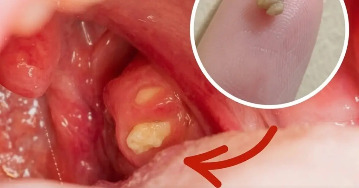 Suddenly Feel Like Something Is Stuck in Your Throat? No Matter How Much You Swallow, It Won't Go Away...