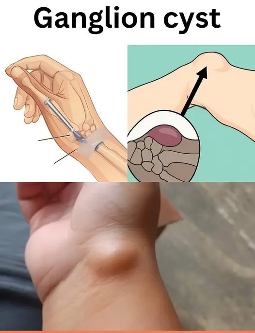 Healing Power And Important Safety Tips Of Castor Leaves