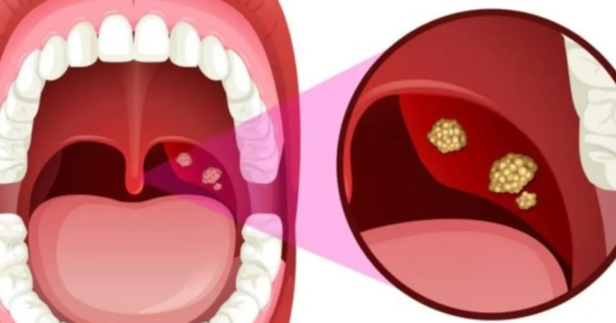 Want Fresher Breath in the Morning? These 6 Nighttime Habits Could Make a Difference