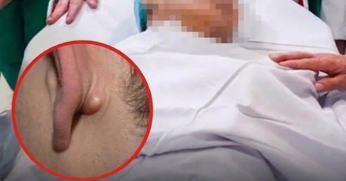 Young Man Dies After Ignoring Two Nighttime Symptoms: A Reminder About Early Cancer Warning Signs