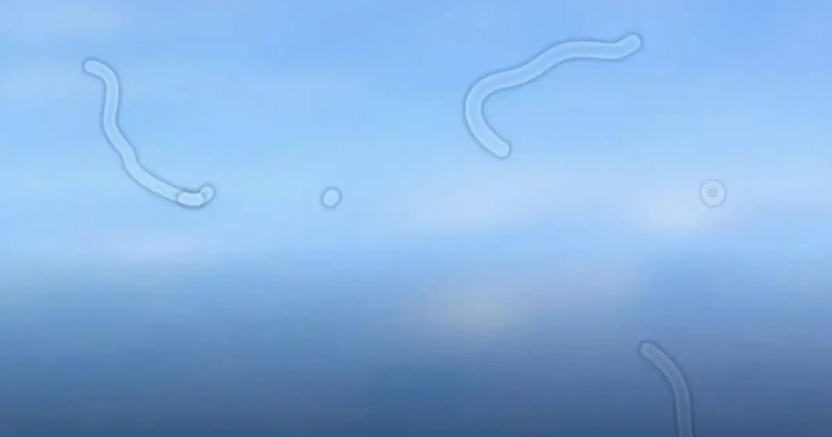 Eye Doctor Explains What Those “Floating Spots” in Your Vision Could Mean