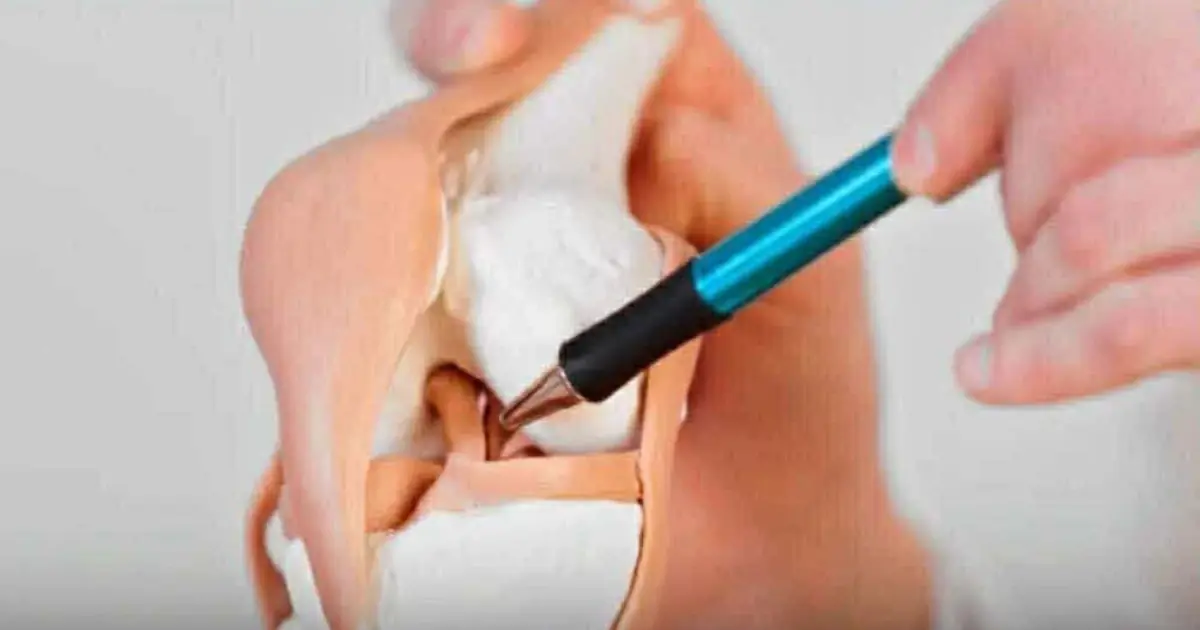6 Foods That May Contribute to Calcium Loss and Weaker Bones
