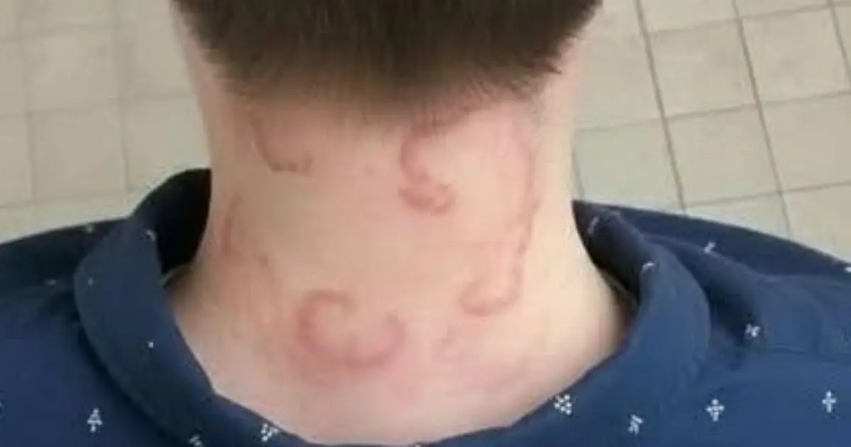 My 8-Year-Old Has Had This for 2 Months, and It’s Getting Worse - What Could It Be?