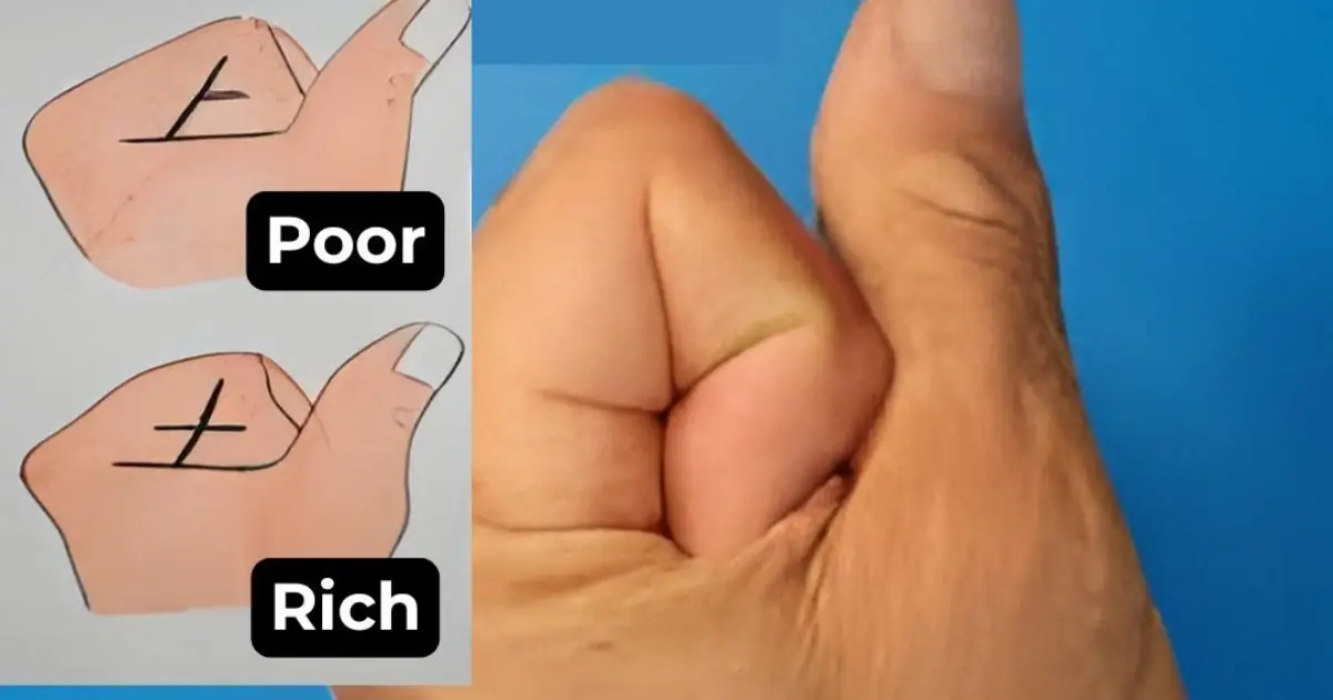 Can the Lines on Your Palm Reveal Whether You’ll Be Rich or P00r?