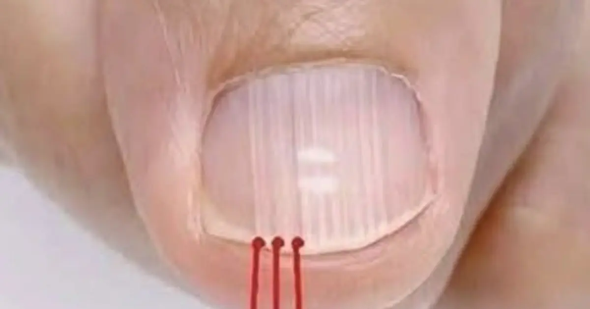 Those little ridges on your nails after 40 can actually be telling you something.