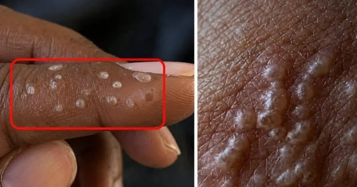 I always wondered what that was... You might have...