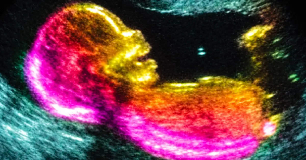 Scientists Are Uncovering New Clues About Autism — But There Is No Single Cause