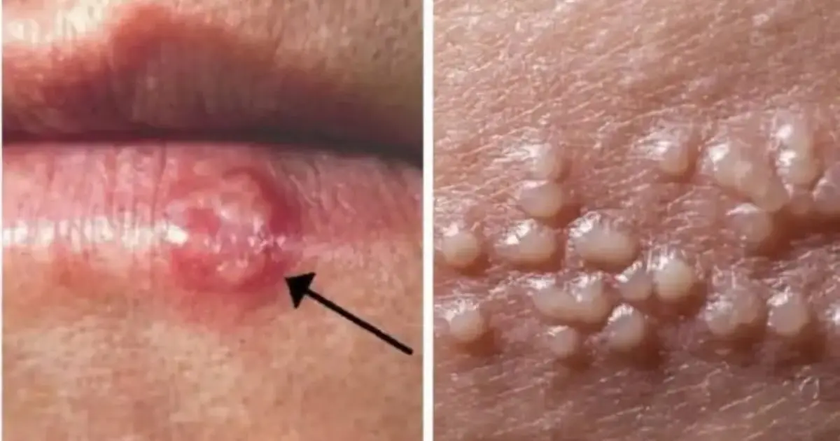10 Subtle Warning Signs Your Body May Be Sending You